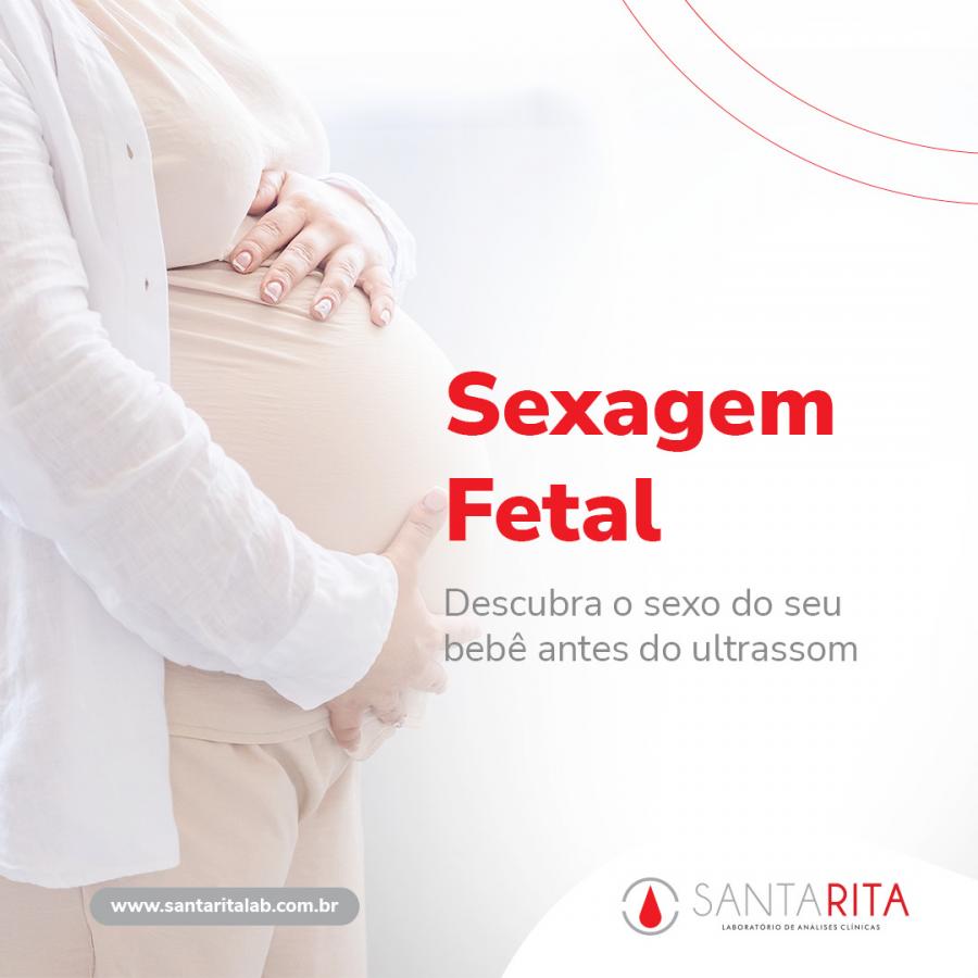 Sexagem Fetal