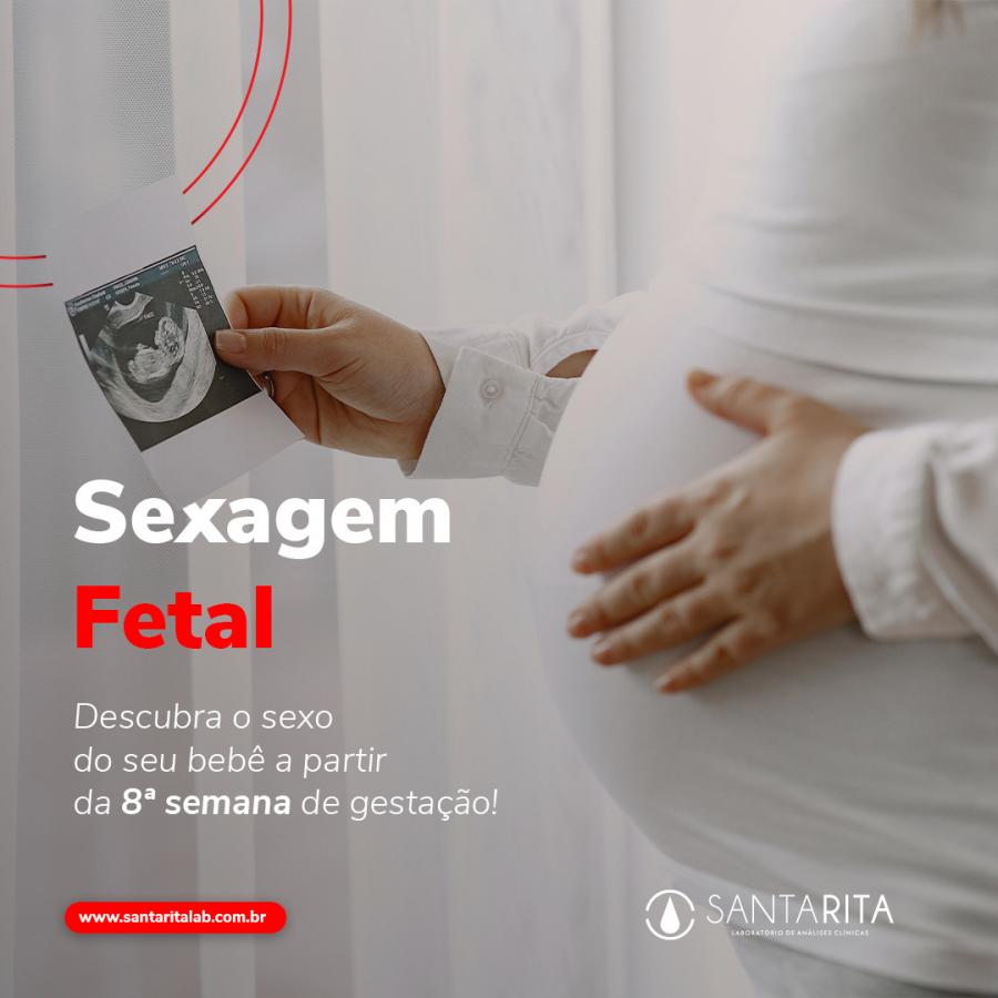 Sexagem Fetal