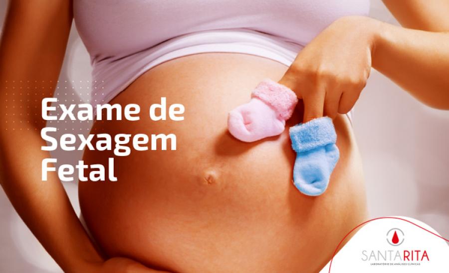 Sexagem Fetal